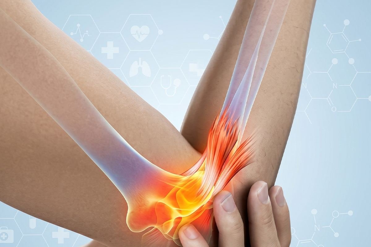 잠실 팔꿈치통증·테니스엘보·골프엘보 — 팔꿈치 통증 부위 일러스트